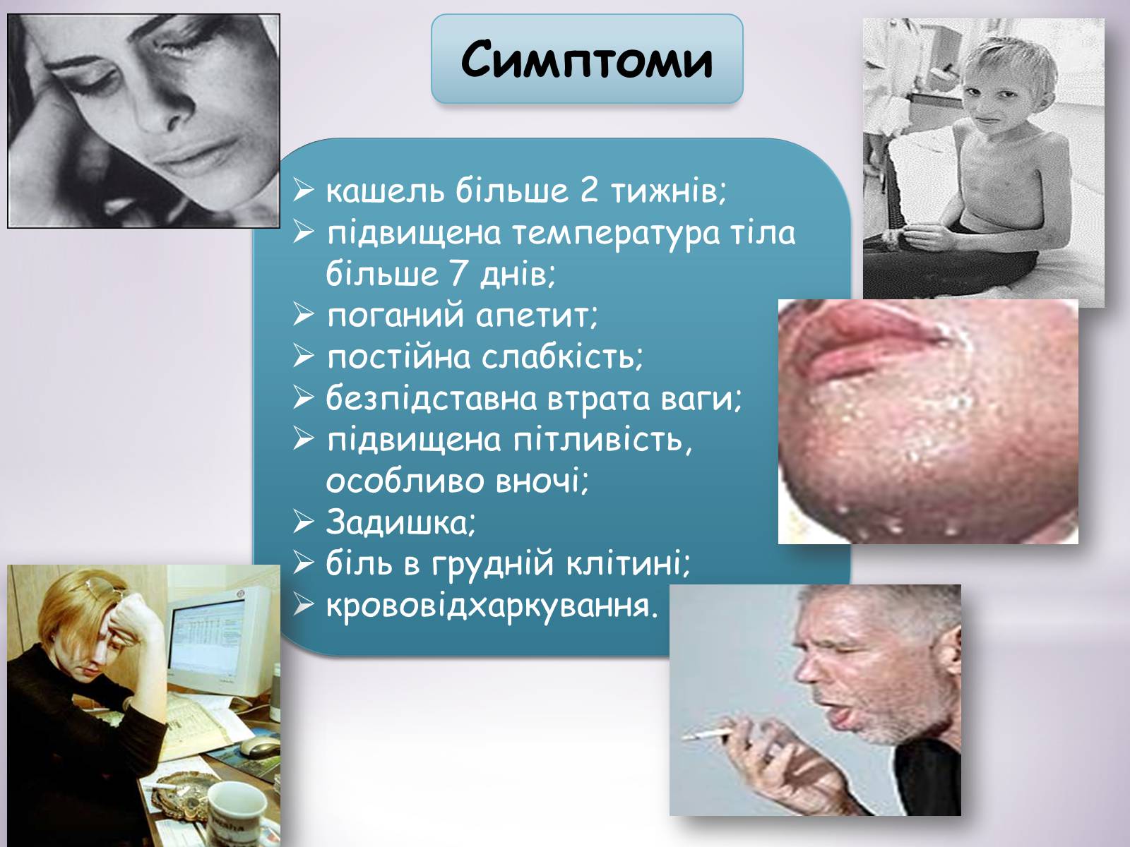 Презентація на тему «Туберкульоз» (варіант 6) - Слайд #3 Презентація на тему «Туберкульоз» (варіант 6) - Слайд #3