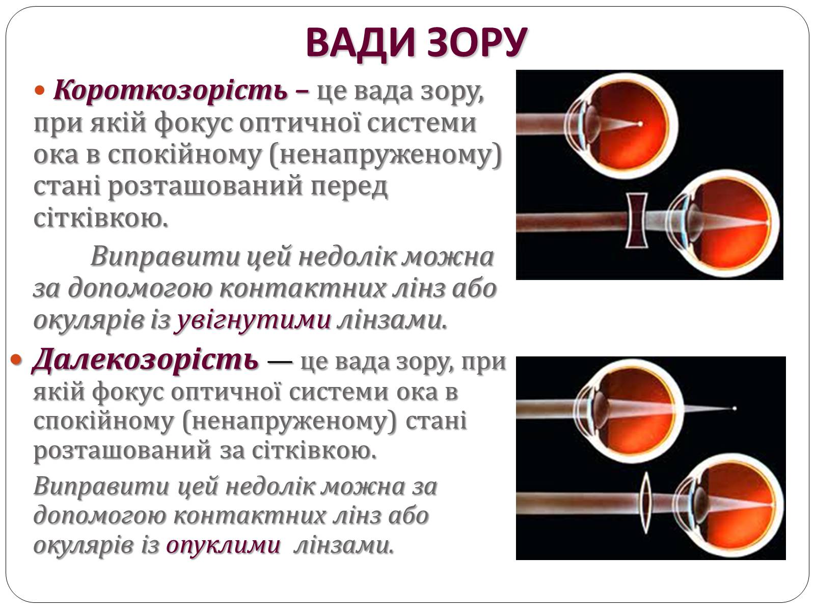 Презентація на тему «Вади Зору» - Слайд #8 Презентація на тему «Вади Зору» - Слайд #8