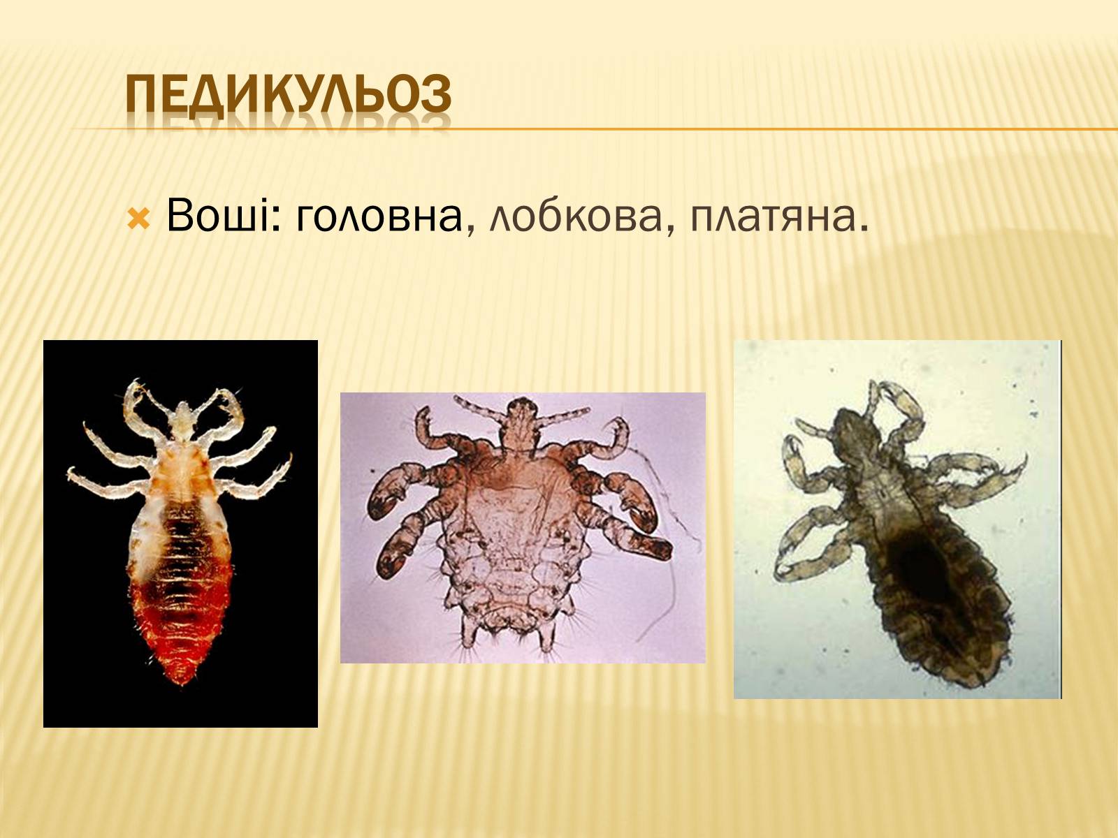 Презентація на тему «Хвороби шкіри» - Слайд #12 Презентація на тему «Хвороби шкіри» - Слайд #12