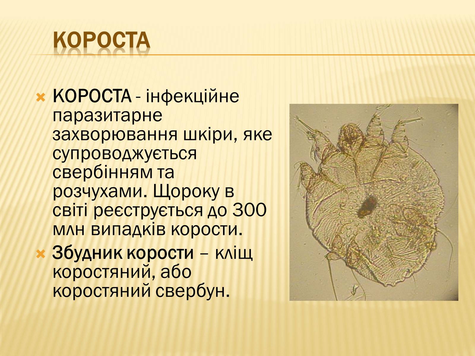 Презентація на тему «Хвороби шкіри» - Слайд #16 Презентація на тему «Хвороби шкіри» - Слайд #16