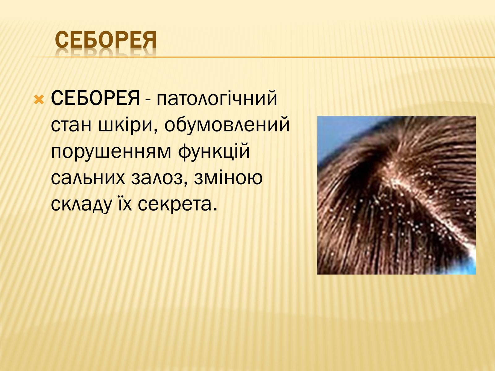 Презентація на тему «Хвороби шкіри» - Слайд #20 Презентація на тему «Хвороби шкіри» - Слайд #20