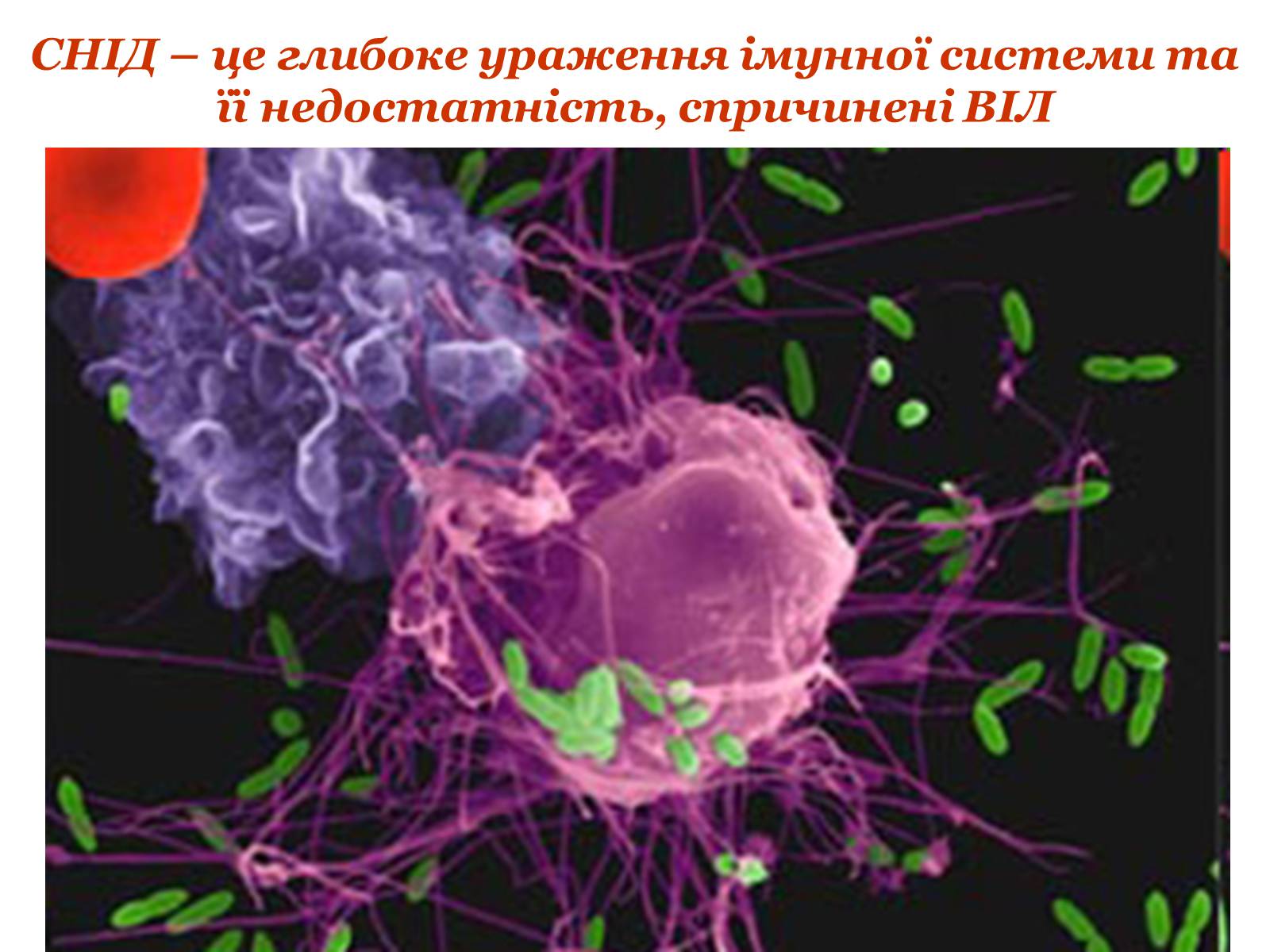 Презентація на тему «ВІЛ. СНІД. інфекції ІПСШ: шляхи передачі і методи захисту» (варіант 9) - Слайд #3 Презентація на тему «ВІЛ. СНІД. інфекції ІПСШ: шляхи передачі і методи захисту» (варіант 9) - Слайд #3