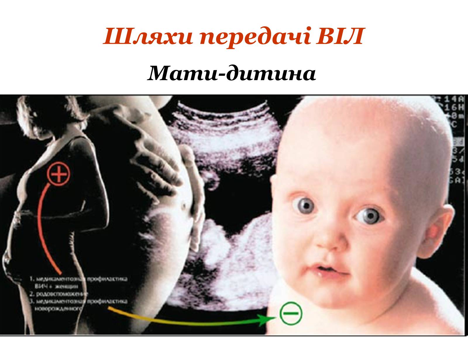 Презентація на тему «ВІЛ. СНІД. інфекції ІПСШ: шляхи передачі і методи захисту» (варіант 9) - Слайд #7 Презентація на тему «ВІЛ. СНІД. інфекції ІПСШ: шляхи передачі і методи захисту» (варіант 9) - Слайд #7
