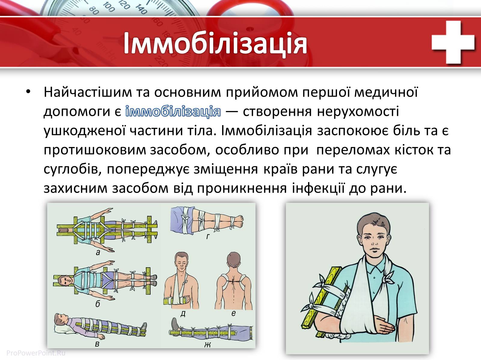 Презентація на тему «Перша медична допомога» (варіант 1) - Слайд #20 Презентація на тему «Перша медична допомога» (варіант 1) - Слайд #20