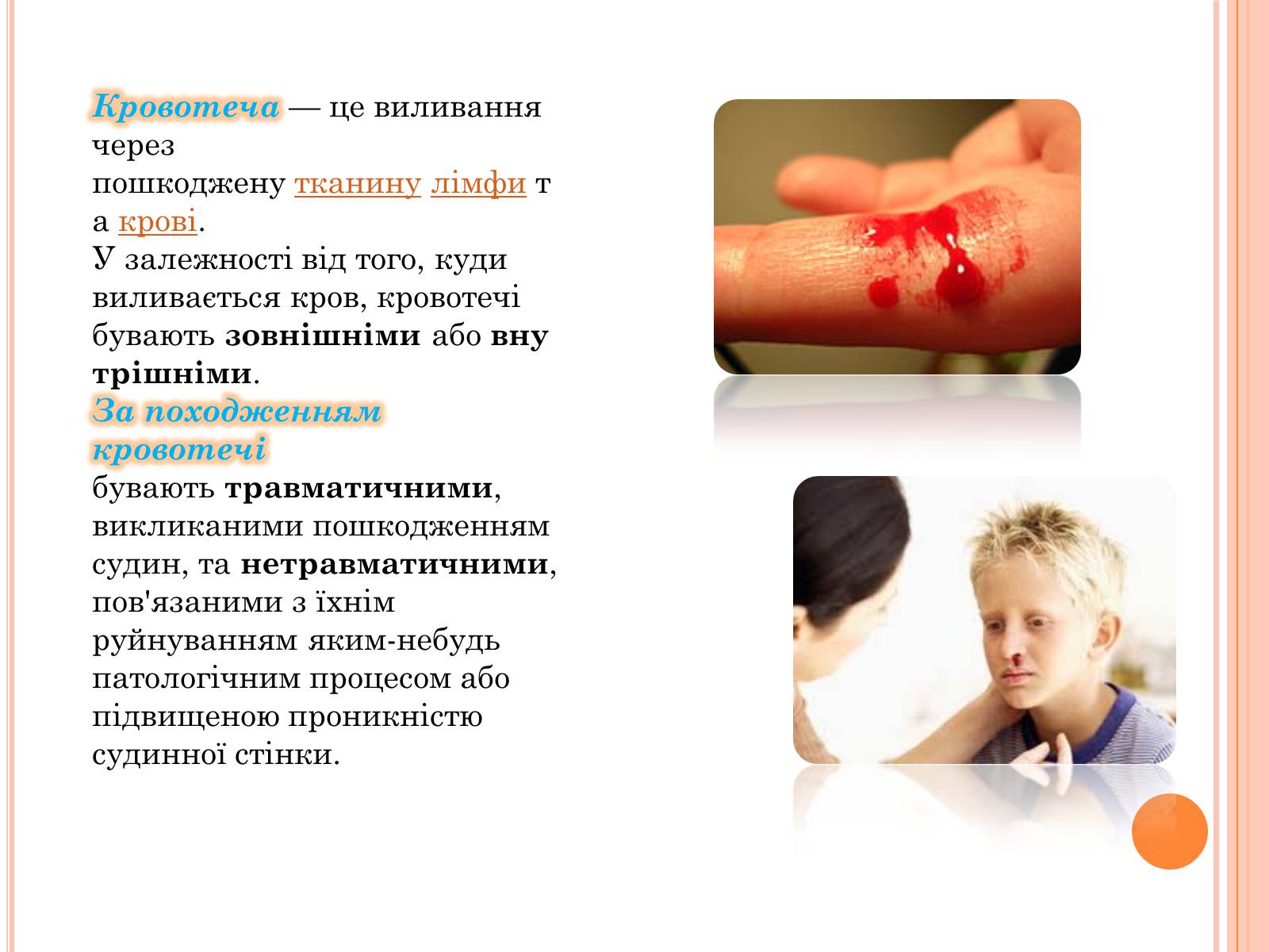 Презентація на тему «Кровотеча та надання першої допомоги при кровотечі» - Слайд #2 Презентація на тему «Кровотеча та надання першої допомоги при кровотечі» - Слайд #2