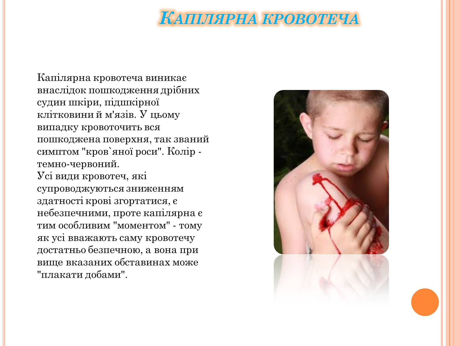 Презентація на тему «Кровотеча та надання першої допомоги при кровотечі» - Слайд #6 Презентація на тему «Кровотеча та надання першої допомоги при кровотечі» - Слайд #6