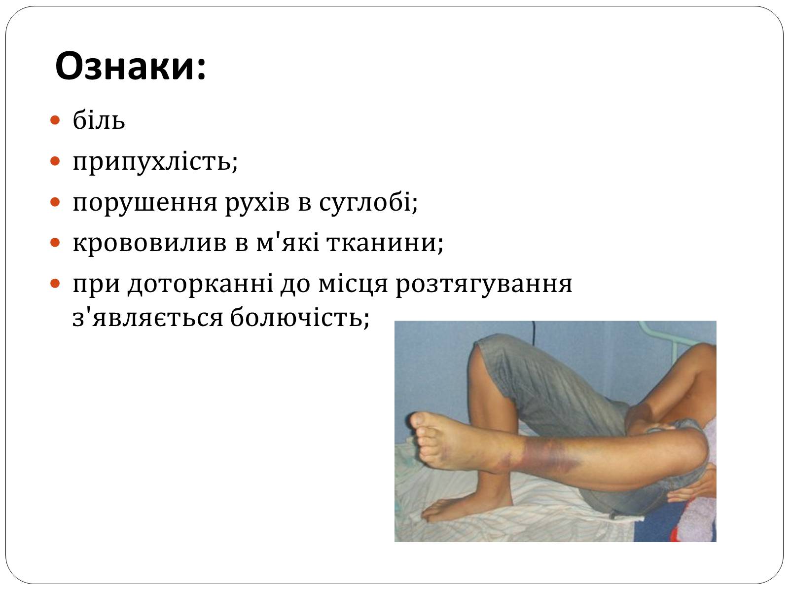 Презентація на тему «Вивихи, розтягнення, переломи. Перша допомога» - Слайд #12 Презентація на тему «Вивихи, розтягнення, переломи. Перша допомога» - Слайд #12