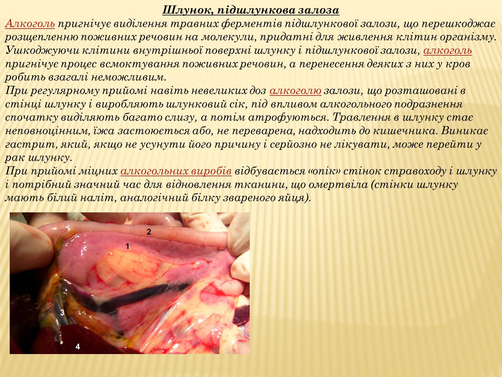 Презентація на тему «Шкідливий вплив уживання алкоголю, наркотичних речовин, тютюнокуріння на організм людини» - Слайд #4 Презентація на тему «Шкідливий вплив уживання алкоголю, наркотичних речовин, тютюнокуріння на організм людини» - Слайд #4