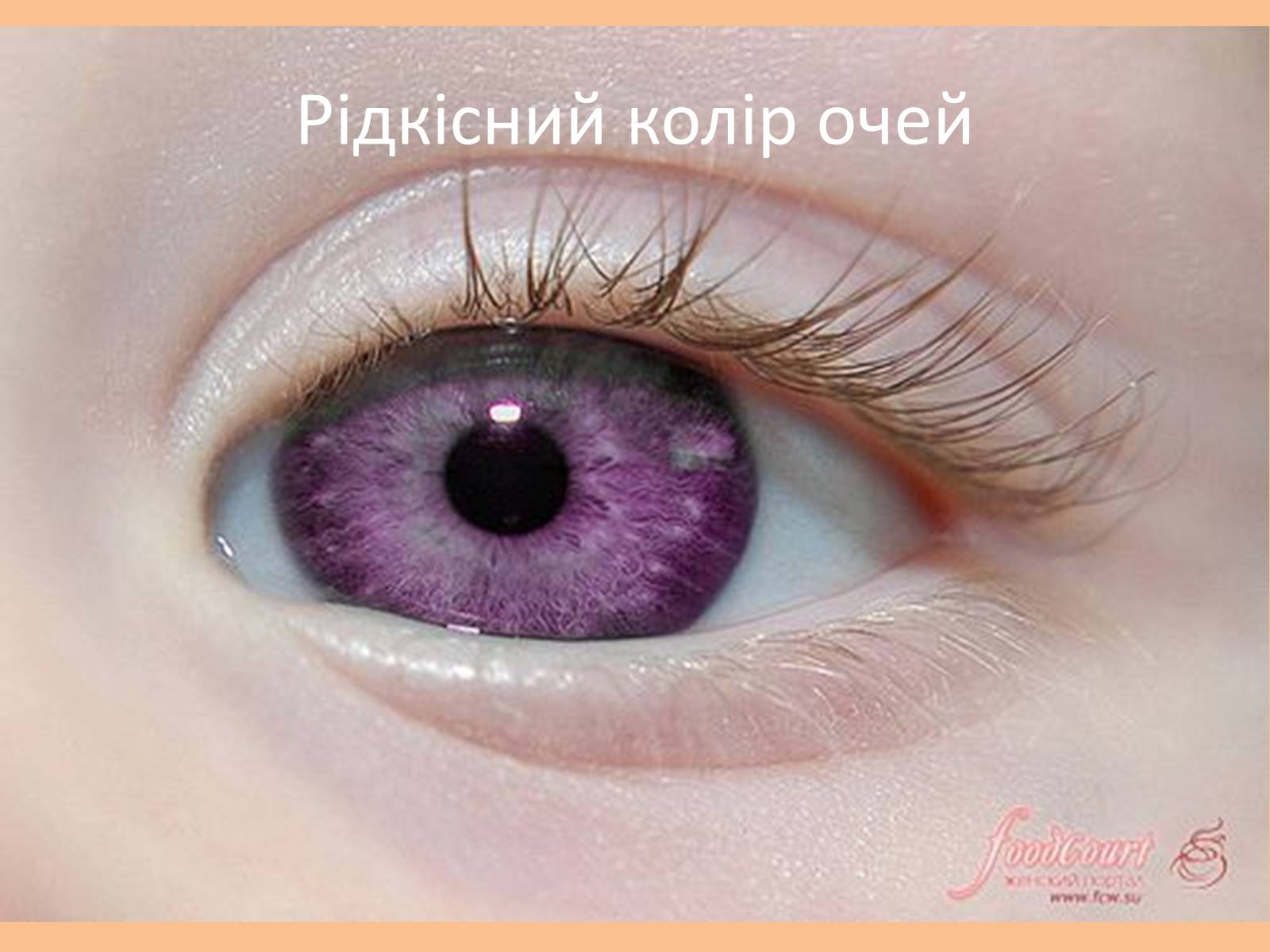 Презентація на тему «Зорова сенсорна система» - Слайд #33 Презентація на тему «Зорова сенсорна система» - Слайд #33
