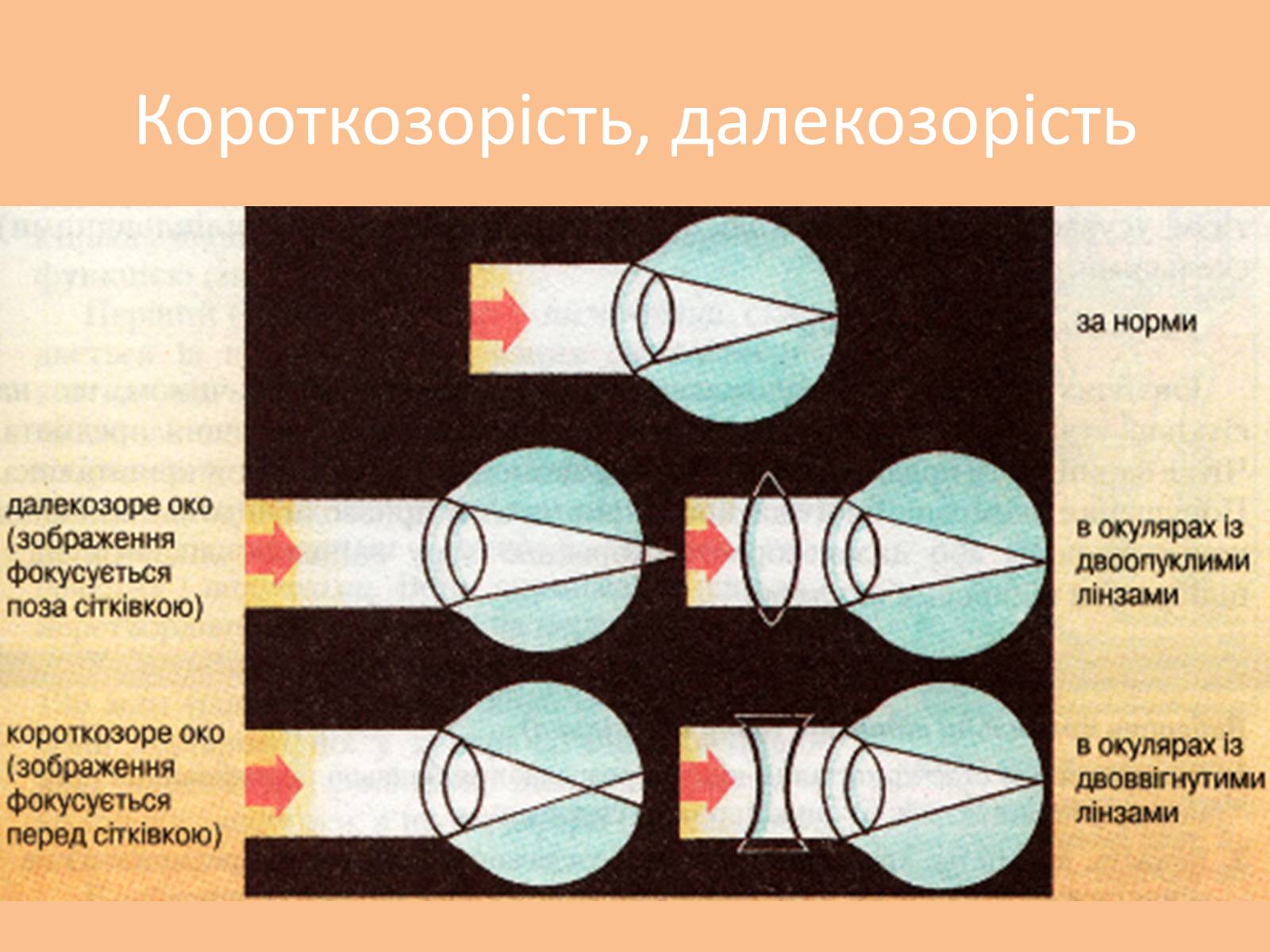 Презентація на тему «Зорова сенсорна система» - Слайд #6 Презентація на тему «Зорова сенсорна система» - Слайд #6