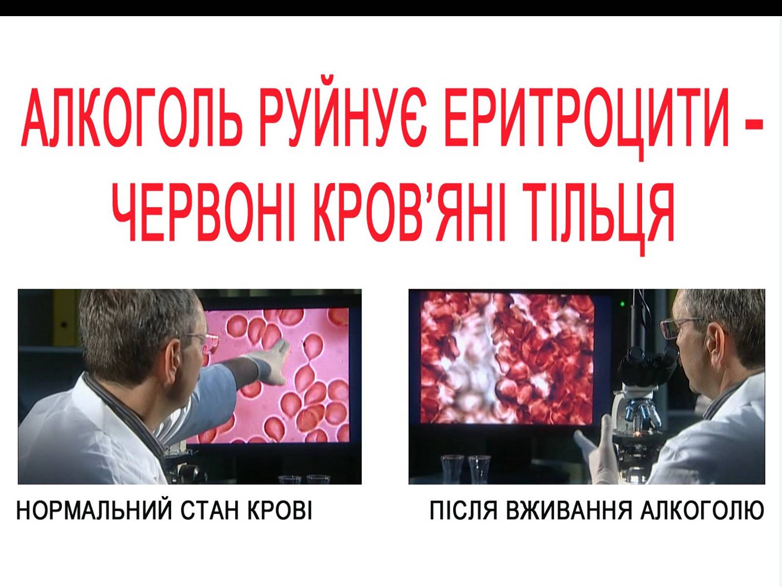 Презентація на тему «Алкоголь і алкоголізм» - Слайд #14 Презентація на тему «Алкоголь і алкоголізм» - Слайд #14