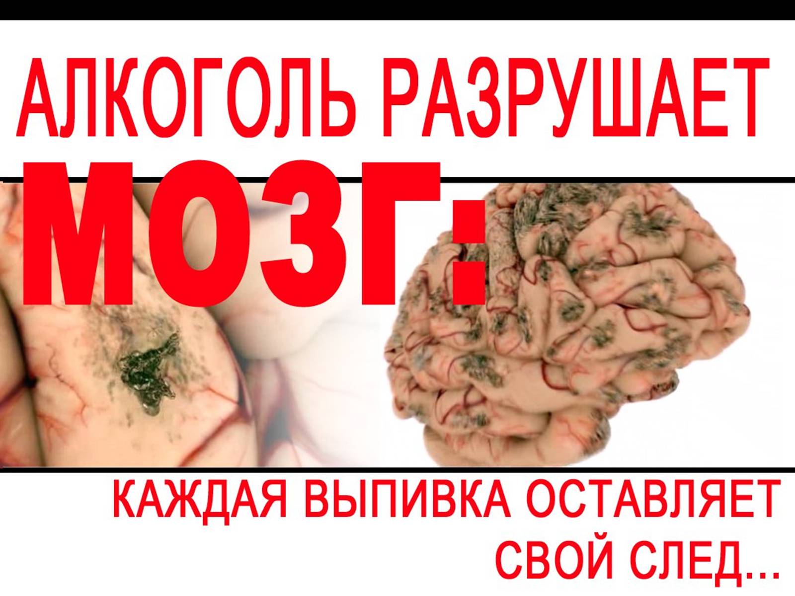 Презентація на тему «Алкоголь і алкоголізм» - Слайд #15 Презентація на тему «Алкоголь і алкоголізм» - Слайд #15