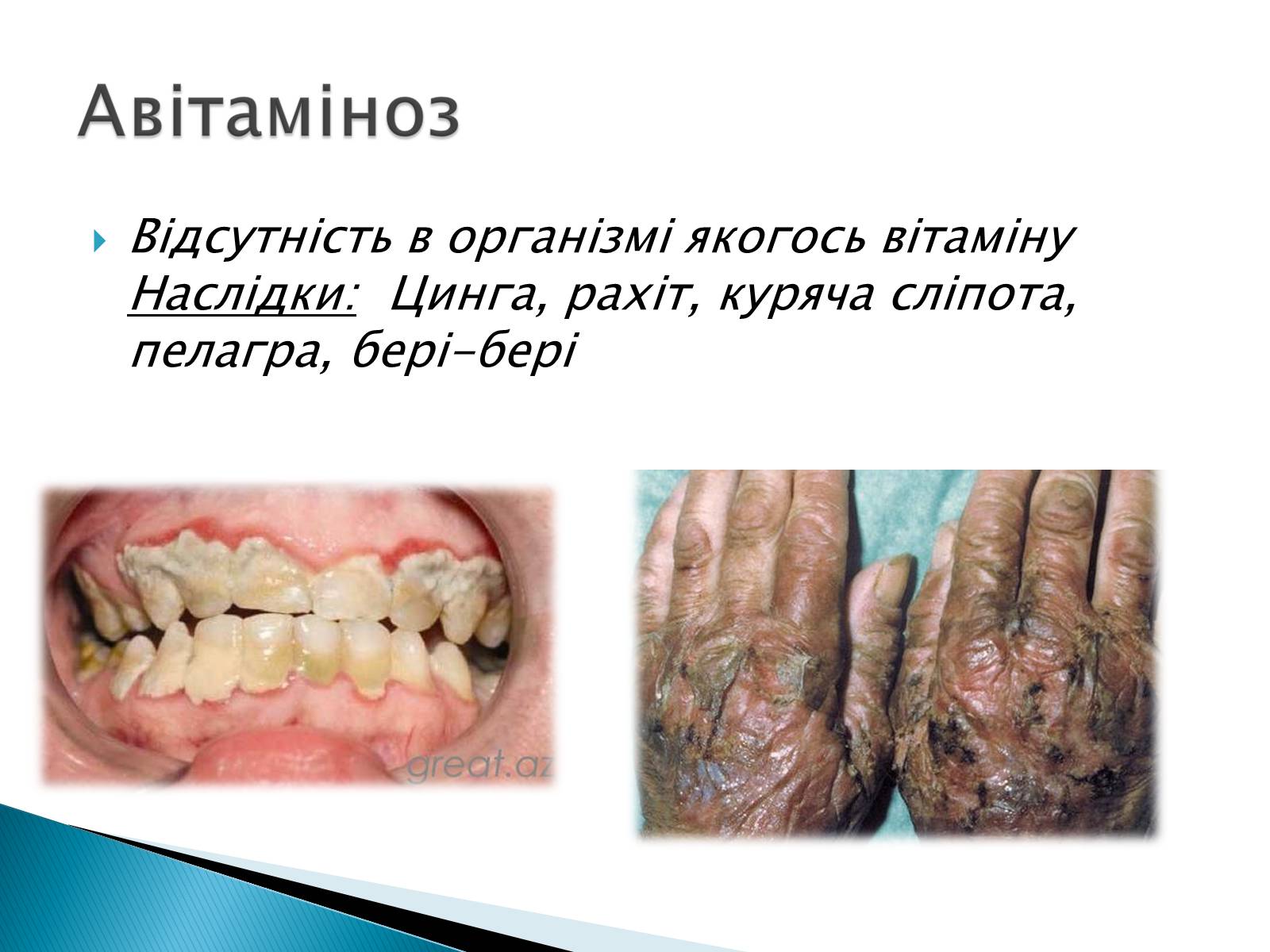 Презентація на тему «Вітаміни» (варіант 10) - Слайд #19 Презентація на тему «Вітаміни» (варіант 10) - Слайд #19