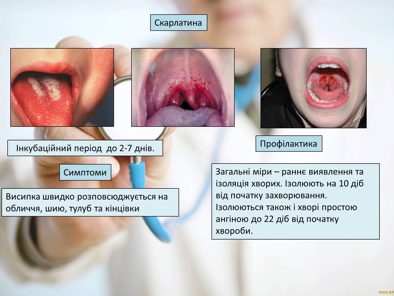 Презентація на тему «Профілактика інфекційних захворювань» (варіант 6) - Слайд #5 Презентація на тему «Профілактика інфекційних захворювань» (варіант 6) - Слайд #5
