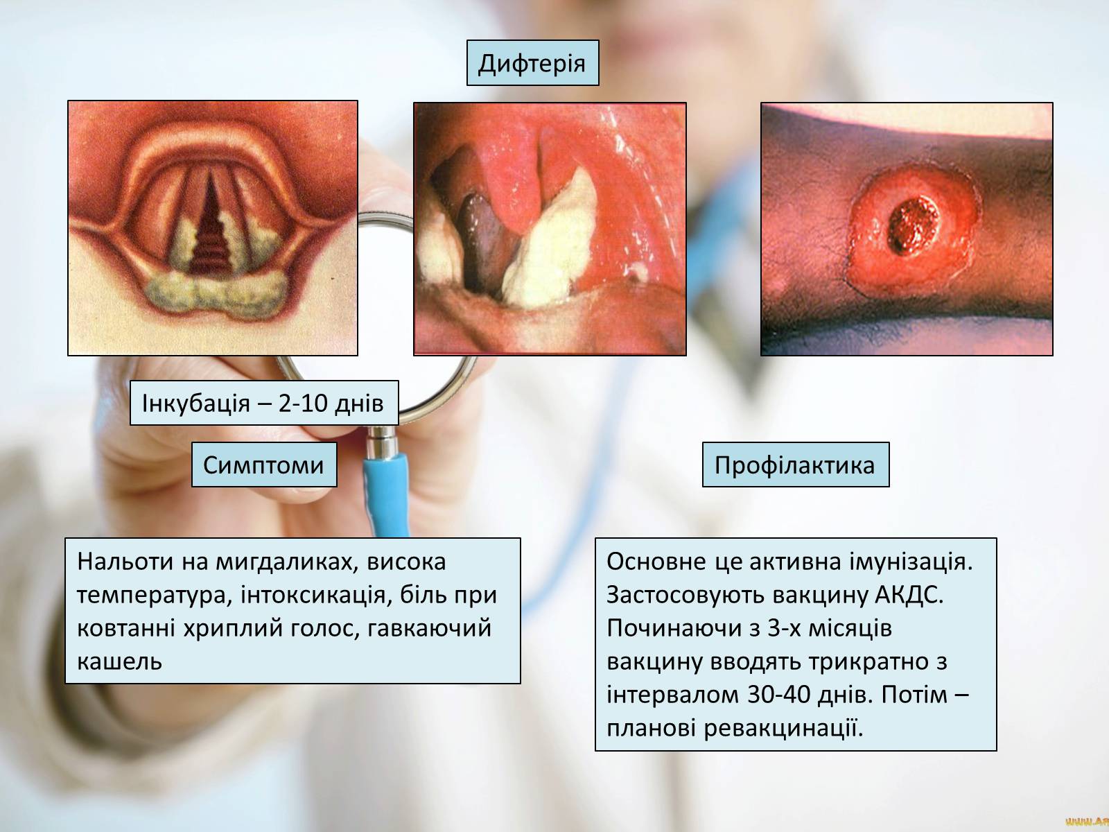 Презентація на тему «Профілактика інфекційних захворювань» (варіант 6) - Слайд #7 Презентація на тему «Профілактика інфекційних захворювань» (варіант 6) - Слайд #7