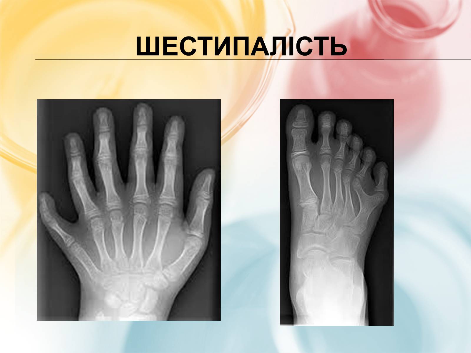 Презентація на тему «Хромосомна теорія спадковості» (варіант 3) - Слайд #12 Презентація на тему «Хромосомна теорія спадковості» (варіант 3) - Слайд #12