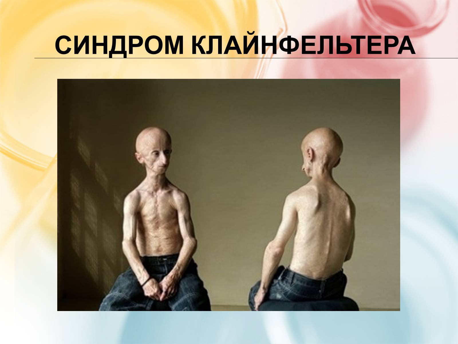 Презентація на тему «Хромосомна теорія спадковості» (варіант 3) - Слайд #14 Презентація на тему «Хромосомна теорія спадковості» (варіант 3) - Слайд #14