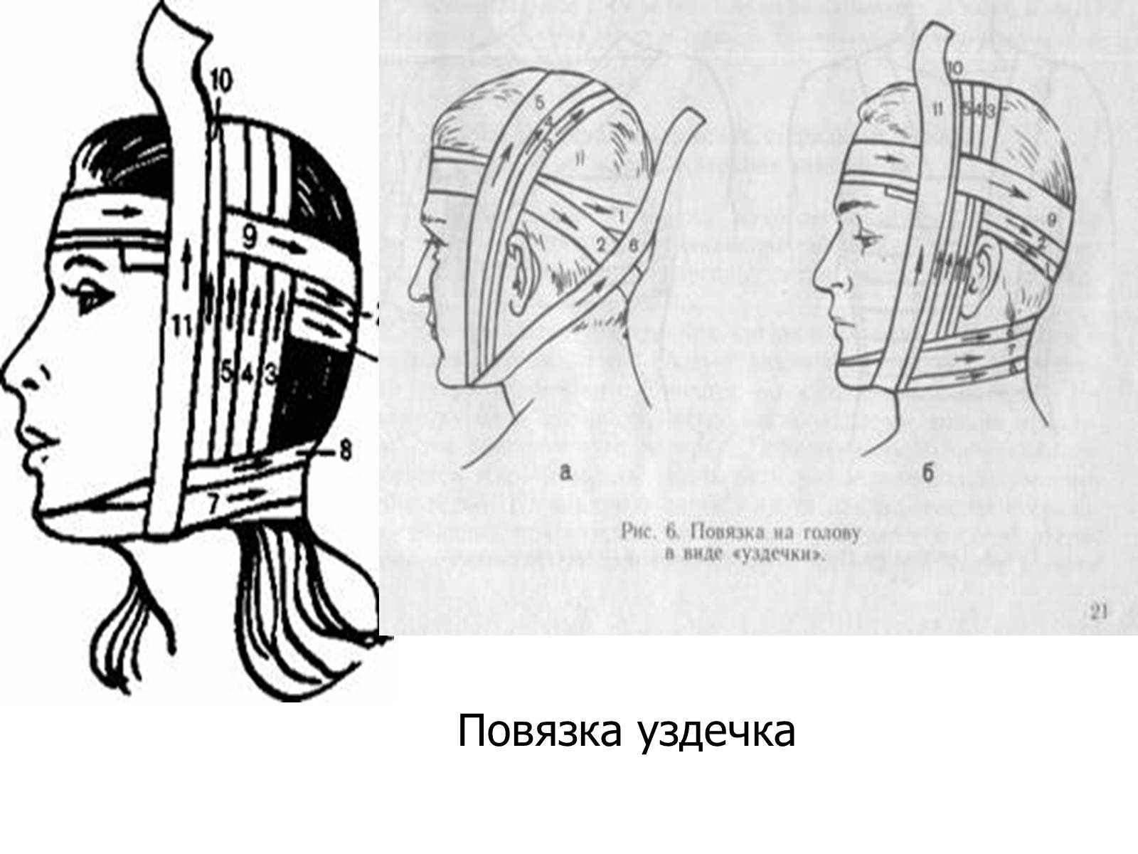Презентація на тему «Накладання пов’язок» - Слайд #4 Презентація на тему «Накладання пов’язок» - Слайд #4