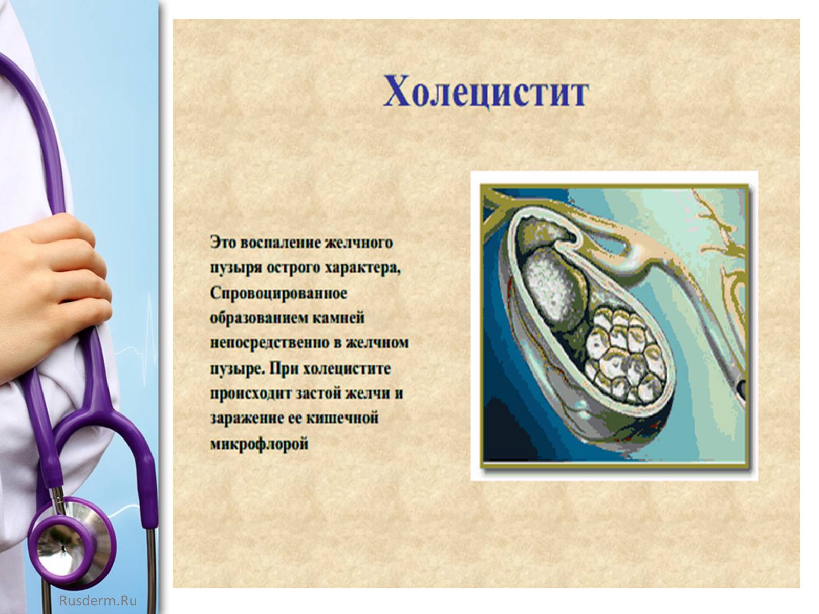 Презентація на тему «Заболевания пищеварительной системы» - Слайд #17 Презентація на тему «Заболевания пищеварительной системы» - Слайд #17