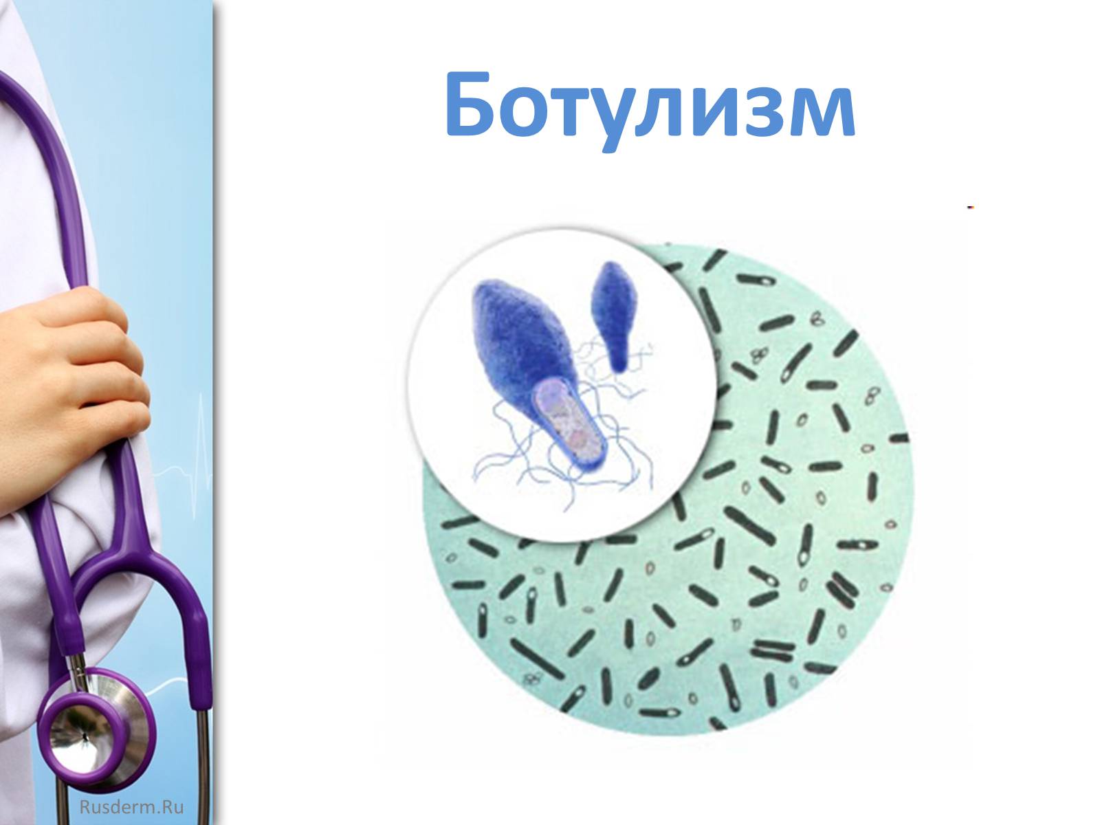 Презентація на тему «Заболевания пищеварительной системы» - Слайд #20 Презентація на тему «Заболевания пищеварительной системы» - Слайд #20