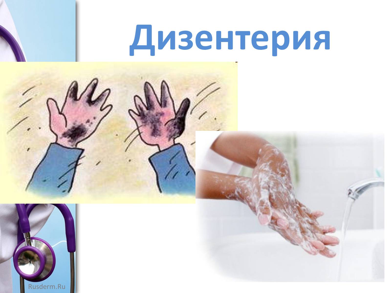 Презентація на тему «Заболевания пищеварительной системы» - Слайд #26 Презентація на тему «Заболевания пищеварительной системы» - Слайд #26
