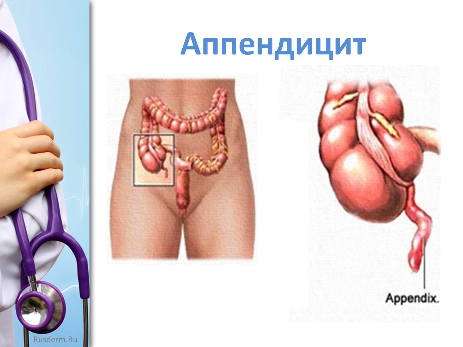 Презентація на тему «Заболевания пищеварительной системы» - Слайд #29 Презентація на тему «Заболевания пищеварительной системы» - Слайд #29