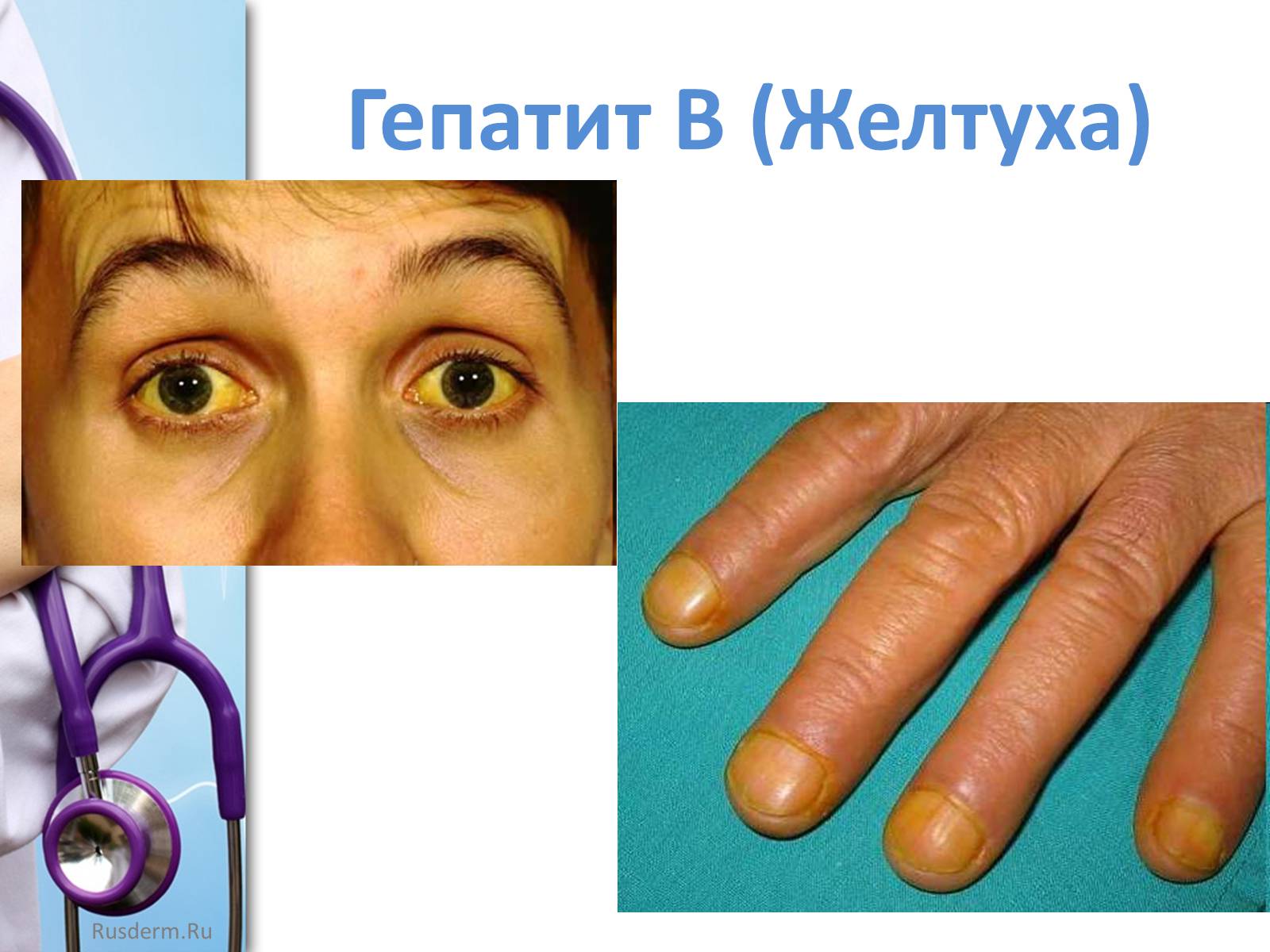 Презентація на тему «Заболевания пищеварительной системы» - Слайд #33 Презентація на тему «Заболевания пищеварительной системы» - Слайд #33