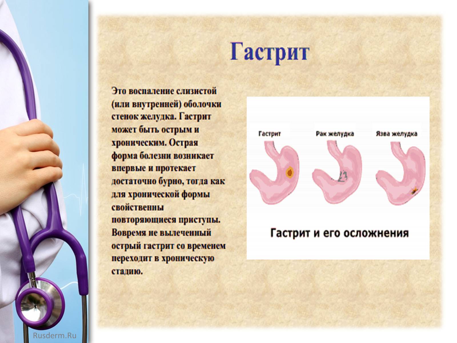 Презентація на тему «Заболевания пищеварительной системы» - Слайд #4 Презентація на тему «Заболевания пищеварительной системы» - Слайд #4