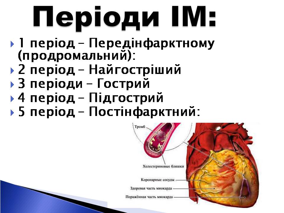 Презентація на тему «Інфаркт міокарда» (варіант 2) - Слайд #4 Презентація на тему «Інфаркт міокарда» (варіант 2) - Слайд #4