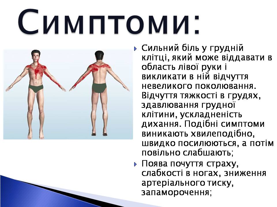 Презентація на тему «Інфаркт міокарда» (варіант 2) - Слайд #6 Презентація на тему «Інфаркт міокарда» (варіант 2) - Слайд #6