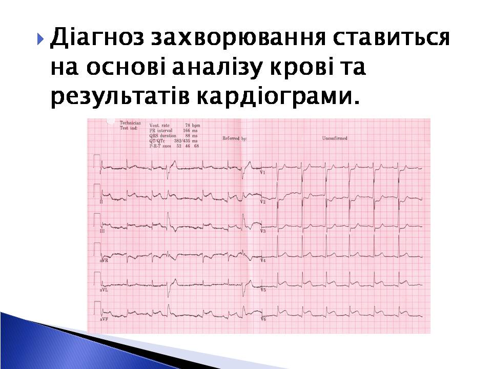 Презентація на тему «Інфаркт міокарда» (варіант 2) - Слайд #7 Презентація на тему «Інфаркт міокарда» (варіант 2) - Слайд #7