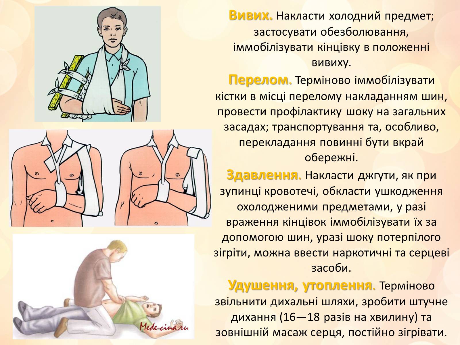Презентація на тему «Перша медична допомога» (варіант 3) - Слайд #10 Презентація на тему «Перша медична допомога» (варіант 3) - Слайд #10