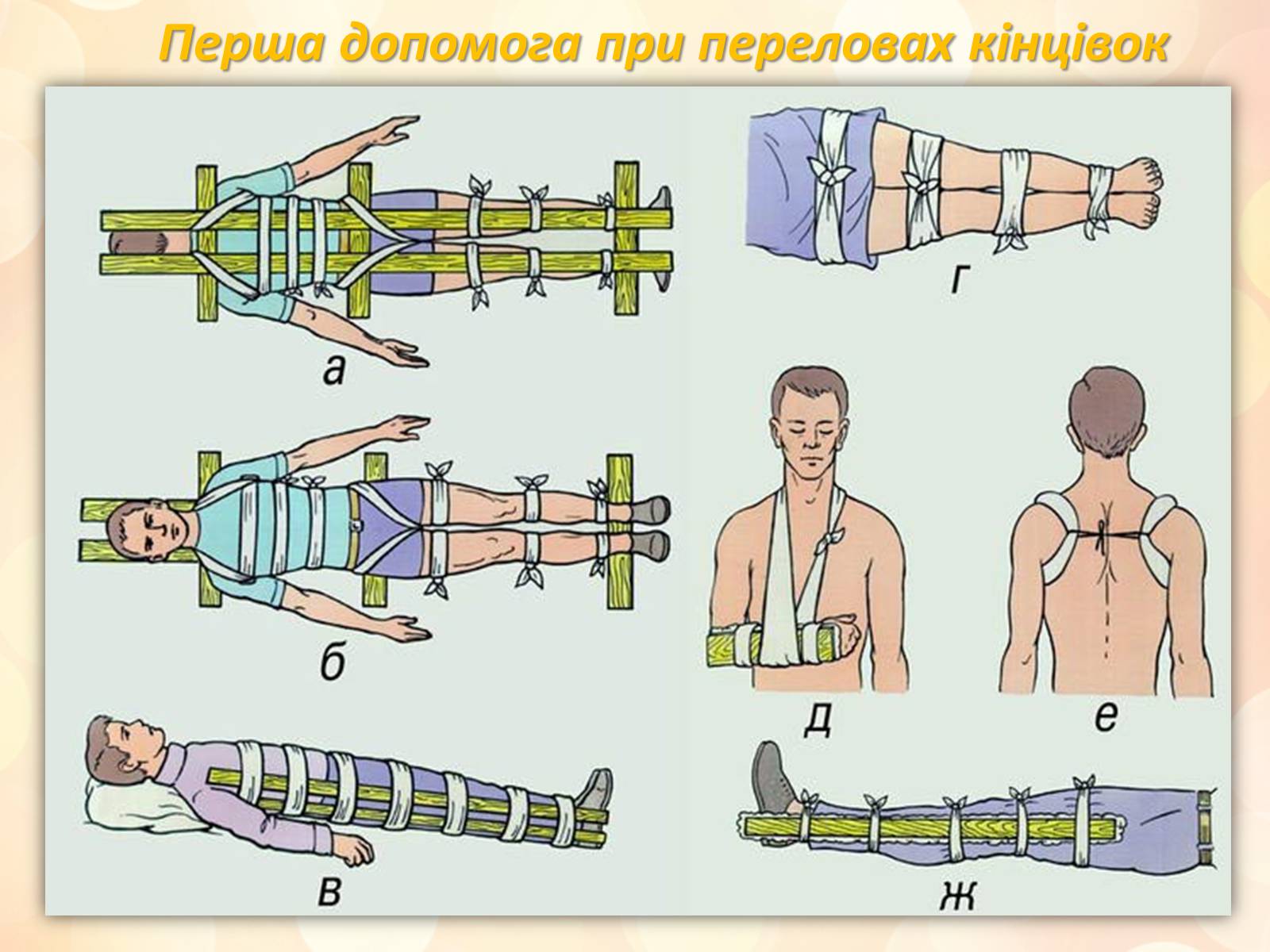 Презентація на тему «Перша медична допомога» (варіант 3) - Слайд #11 Презентація на тему «Перша медична допомога» (варіант 3) - Слайд #11