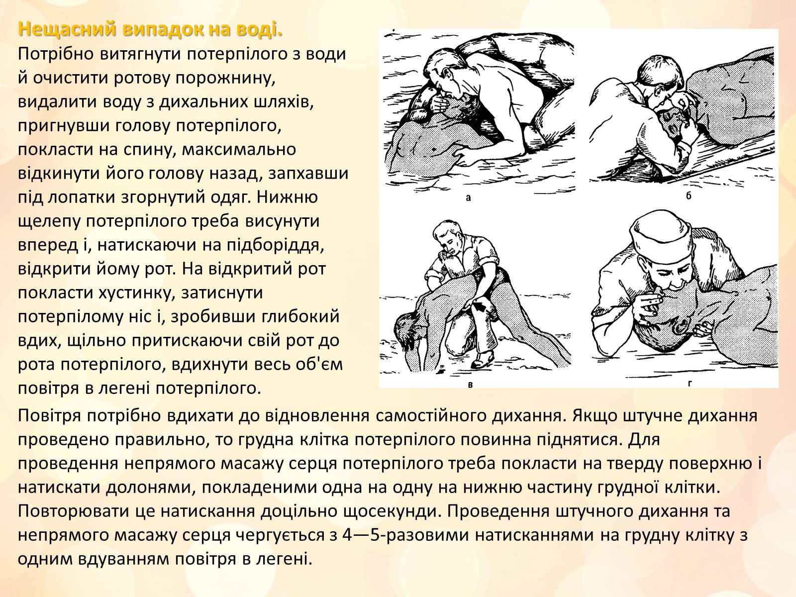 Презентація на тему «Перша медична допомога» (варіант 3) - Слайд #14 Презентація на тему «Перша медична допомога» (варіант 3) - Слайд #14