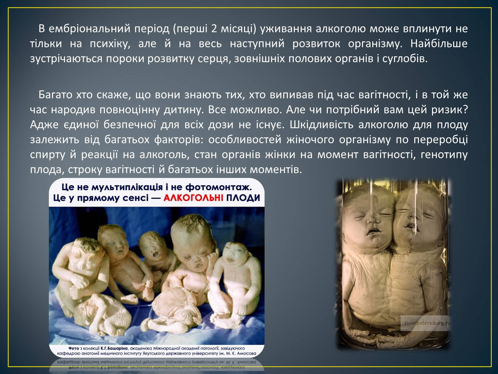 Презентація на тему «Вплив алкоголю, нікотину і наркотичних речовин на зародок людини» - Слайд #5 Презентація на тему «Вплив алкоголю, нікотину і наркотичних речовин на зародок людини» - Слайд #5