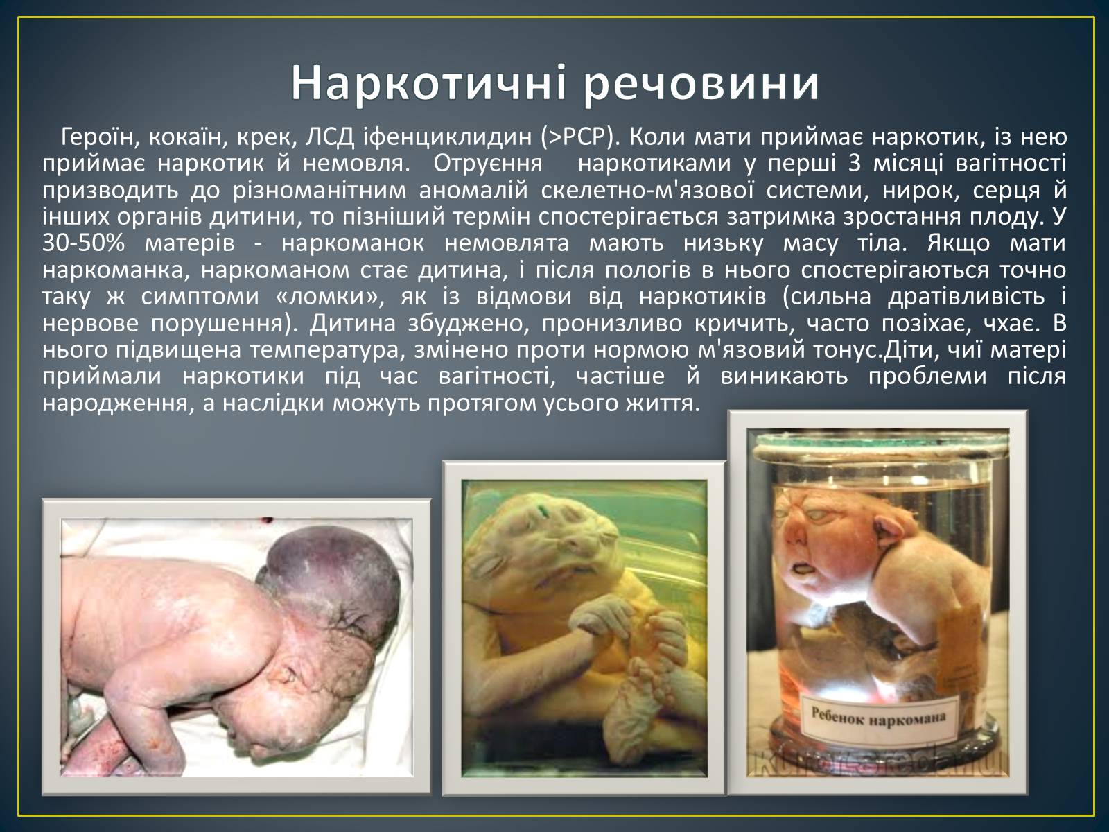 Презентація на тему «Вплив алкоголю, нікотину і наркотичних речовин на зародок людини» - Слайд #8 Презентація на тему «Вплив алкоголю, нікотину і наркотичних речовин на зародок людини» - Слайд #8