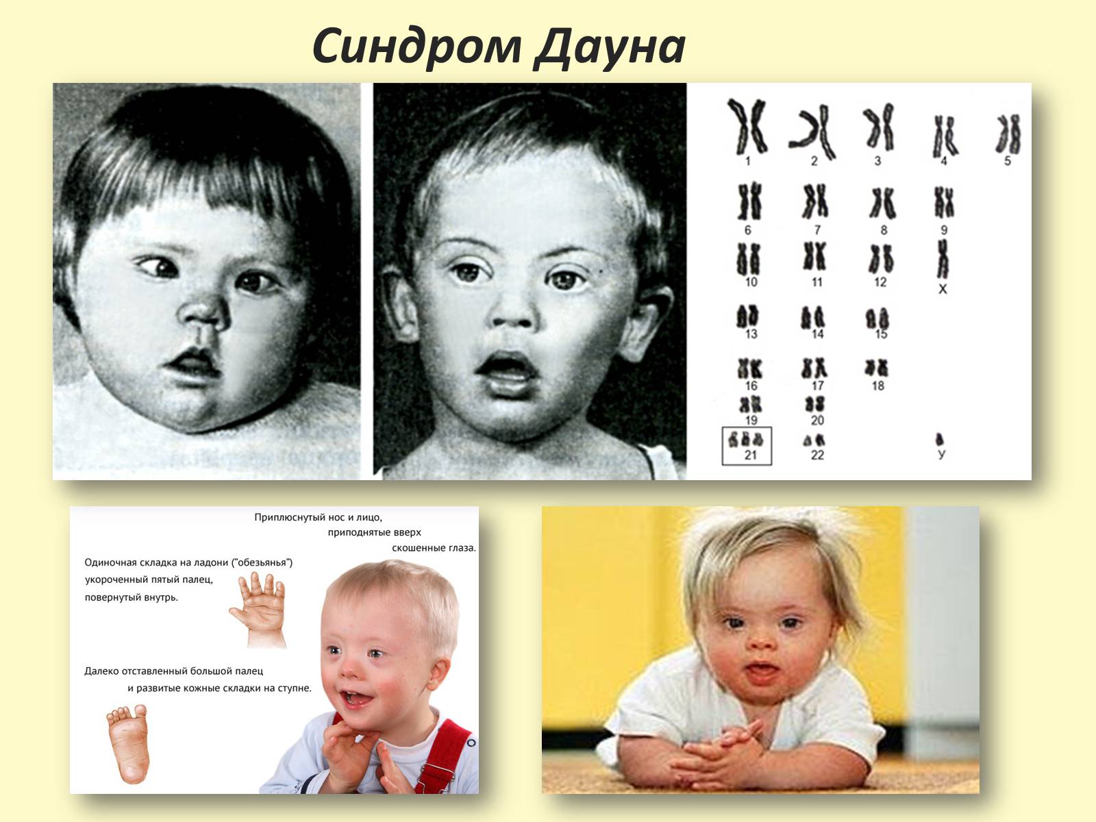 Презентація на тему «Види, причини мутацій. Мутагени» - Слайд #15 Презентація на тему «Види, причини мутацій. Мутагени» - Слайд #15