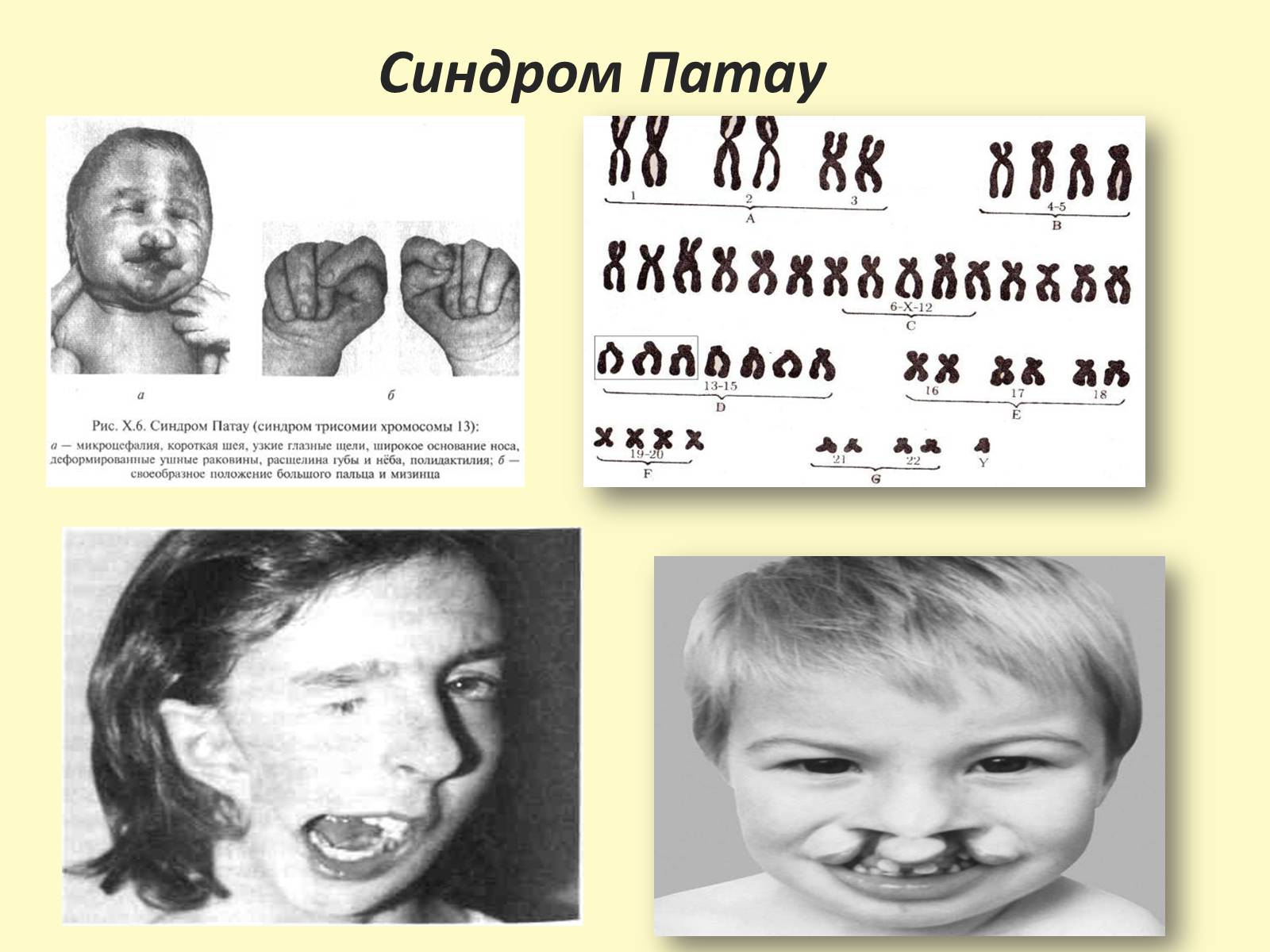 Презентація на тему «Види, причини мутацій. Мутагени» - Слайд #16 Презентація на тему «Види, причини мутацій. Мутагени» - Слайд #16
