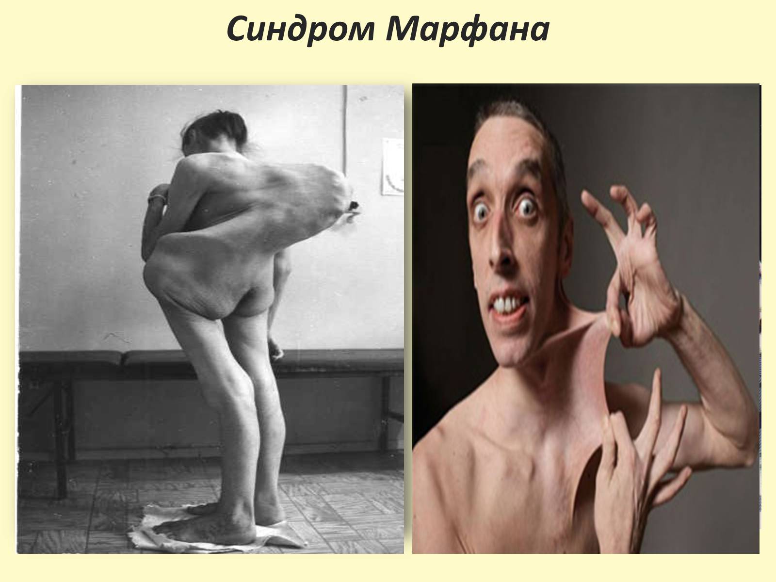 Презентація на тему «Види, причини мутацій. Мутагени» - Слайд #18 Презентація на тему «Види, причини мутацій. Мутагени» - Слайд #18