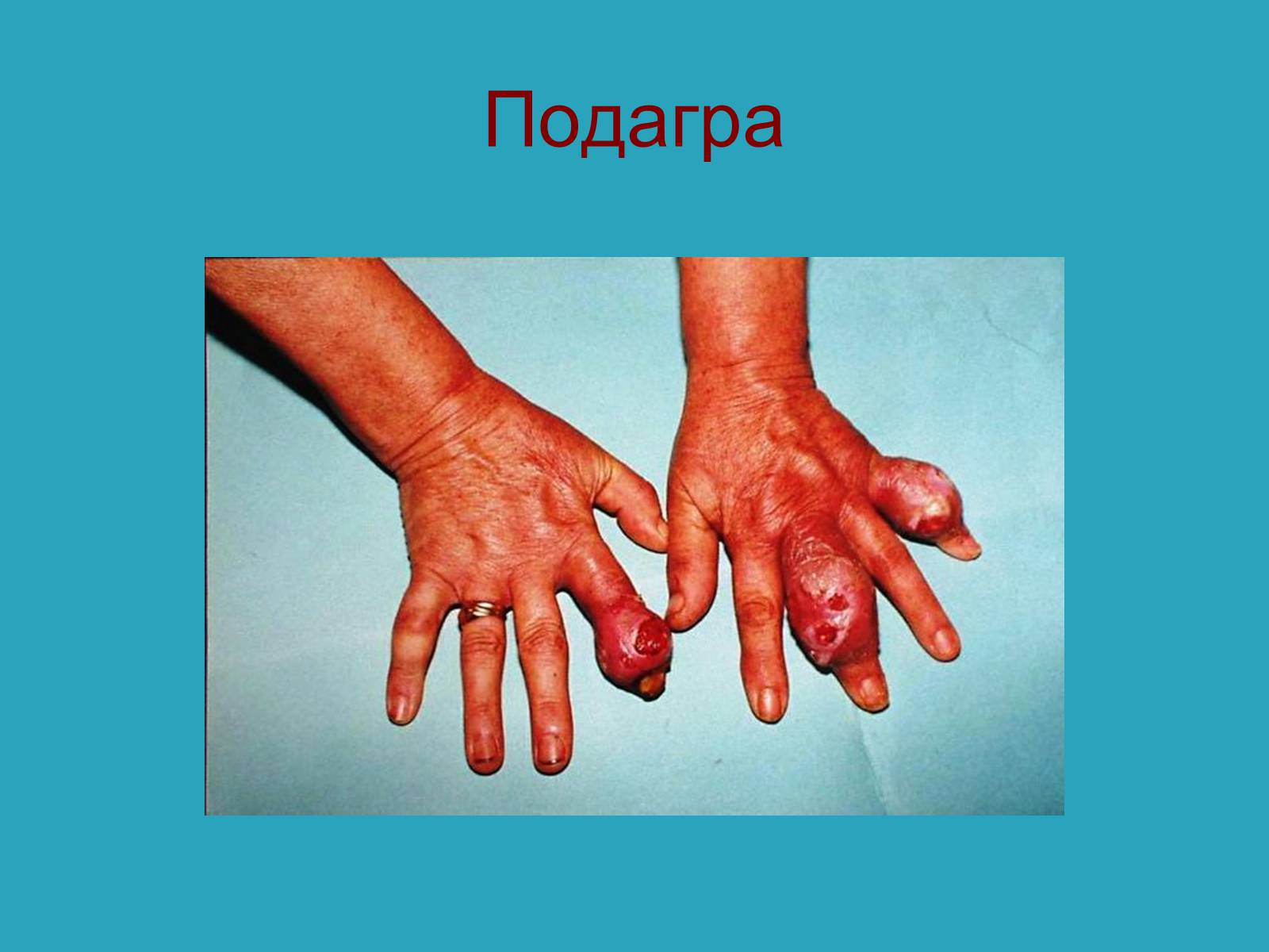 Презентація на тему «Опорно-рухова система» - Слайд #21 Презентація на тему «Опорно-рухова система» - Слайд #21