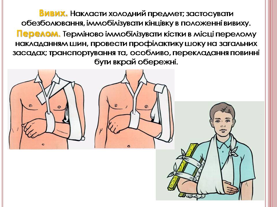 Презентація на тему «Надання першої медичної допомоги» - Слайд #10 Презентація на тему «Надання першої медичної допомоги» - Слайд #10