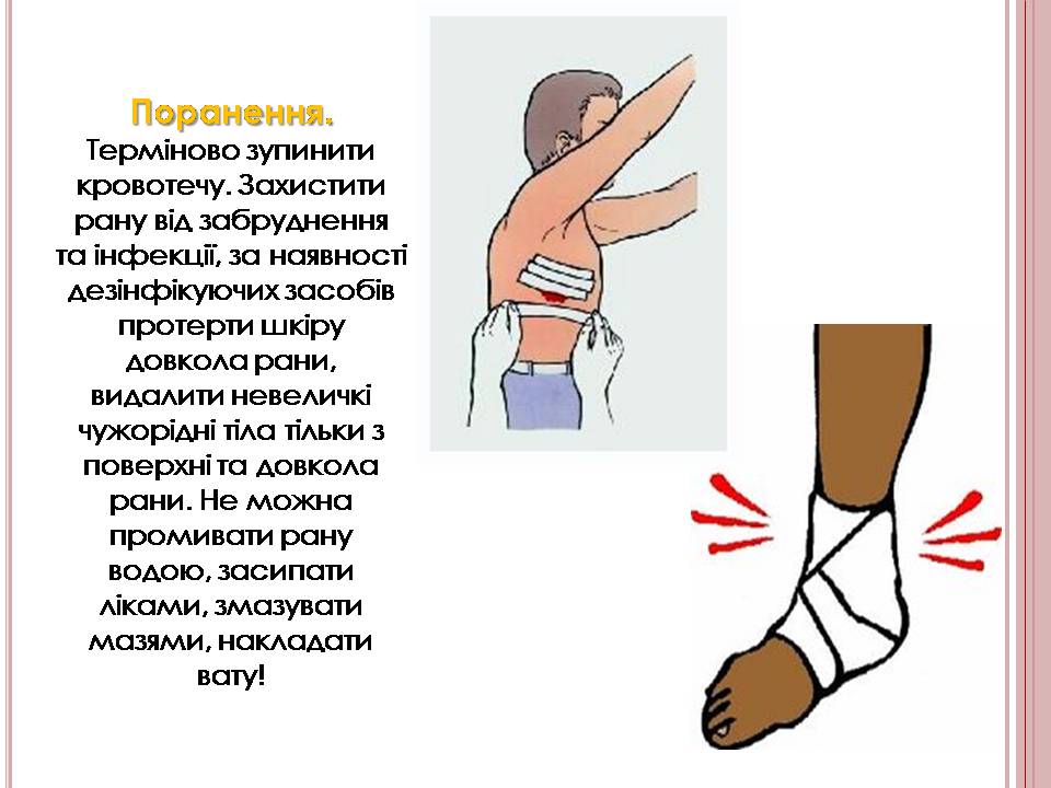 Презентація на тему «Надання першої медичної допомоги» - Слайд #7 Презентація на тему «Надання першої медичної допомоги» - Слайд #7