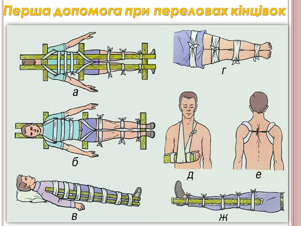 Презентація на тему «Надання першої медичної допомоги» - Слайд #9 Презентація на тему «Надання першої медичної допомоги» - Слайд #9