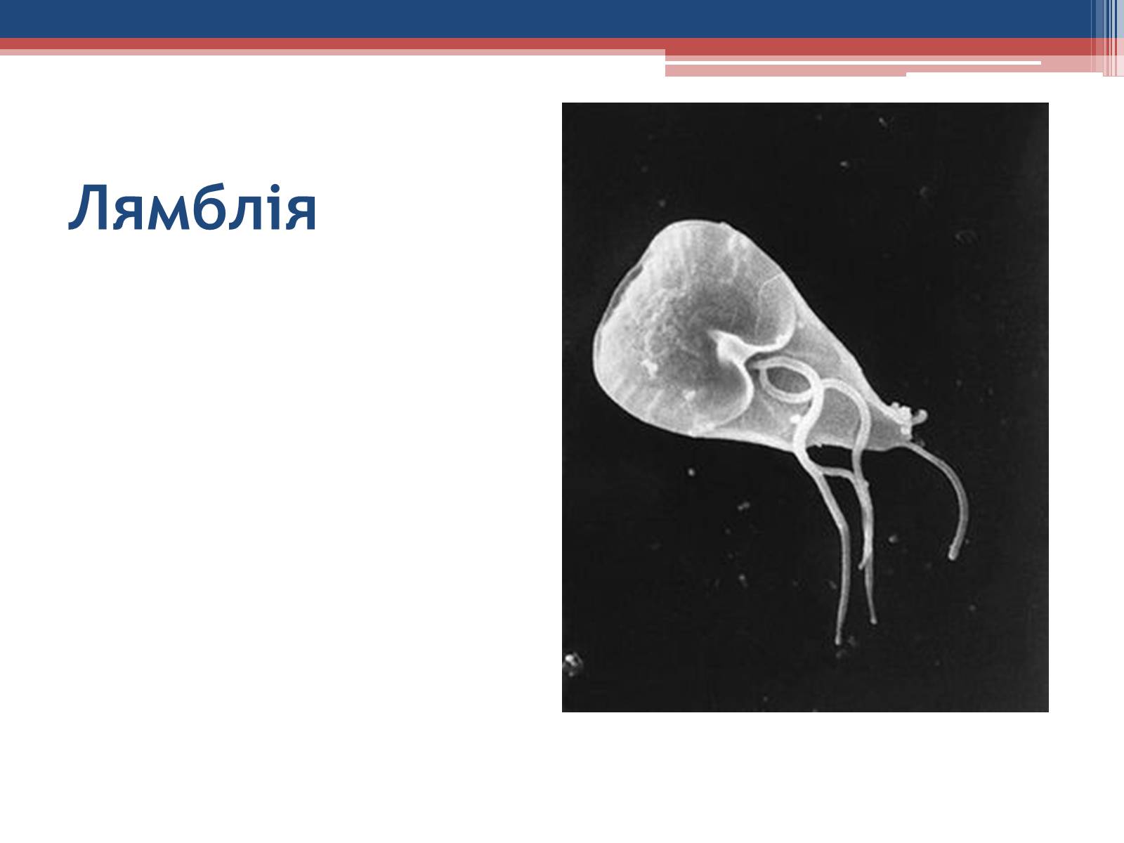 Презентація на тему «Хвороби людини, що викликаються одноклітинними тваринами» - Слайд #14 Презентація на тему «Хвороби людини, що викликаються одноклітинними тваринами» - Слайд #14
