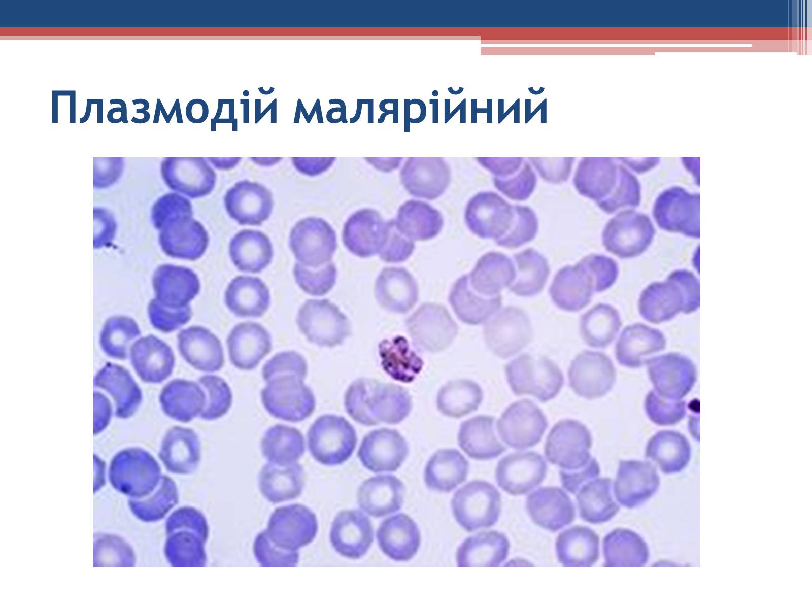 Презентація на тему «Хвороби людини, що викликаються одноклітинними тваринами» - Слайд #18 Презентація на тему «Хвороби людини, що викликаються одноклітинними тваринами» - Слайд #18