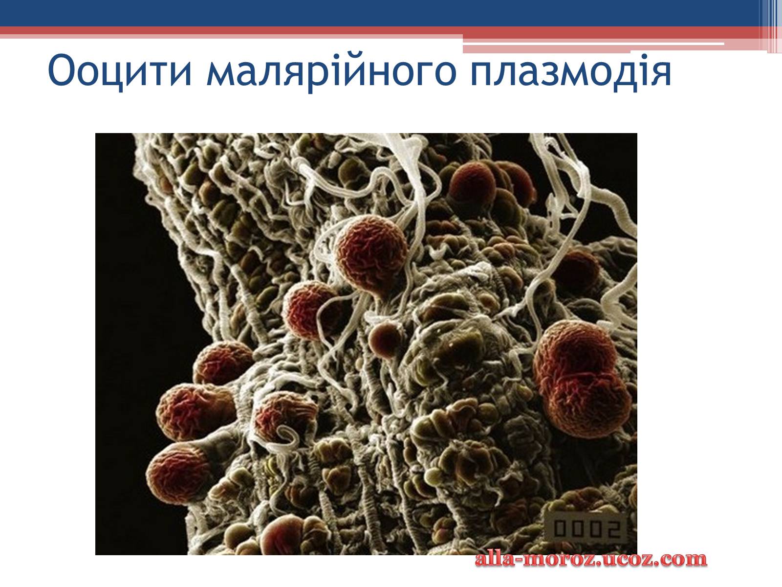 Презентація на тему «Хвороби людини, що викликаються одноклітинними тваринами» - Слайд #24 Презентація на тему «Хвороби людини, що викликаються одноклітинними тваринами» - Слайд #24