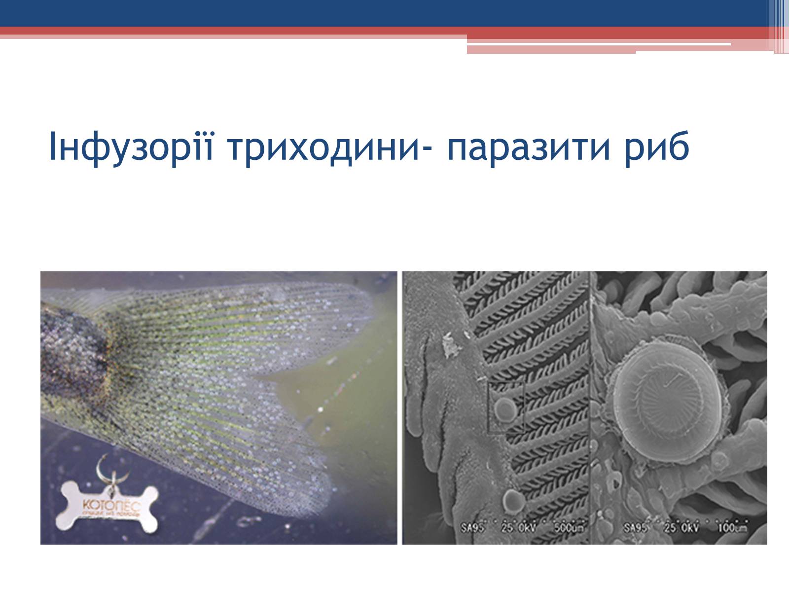 Презентація на тему «Хвороби людини, що викликаються одноклітинними тваринами» - Слайд #25 Презентація на тему «Хвороби людини, що викликаються одноклітинними тваринами» - Слайд #25