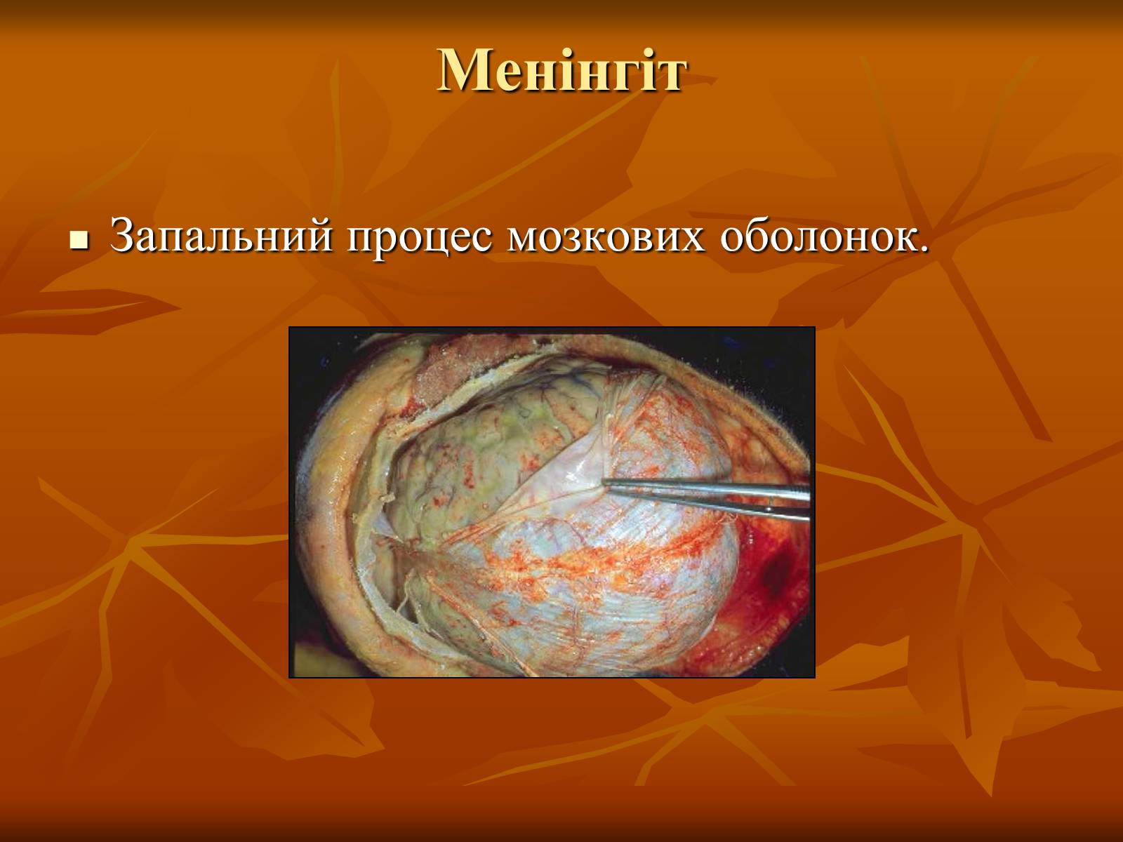 Презентація на тему «Інфекційні захворювання» (варіант 1) - Слайд #10 Презентація на тему «Інфекційні захворювання» (варіант 1) - Слайд #10