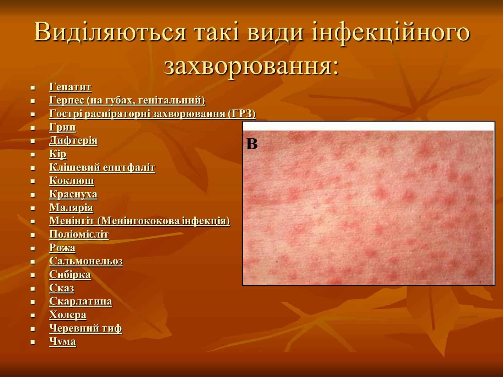 Презентація на тему «Інфекційні захворювання» (варіант 1) - Слайд #9 Презентація на тему «Інфекційні захворювання» (варіант 1) - Слайд #9