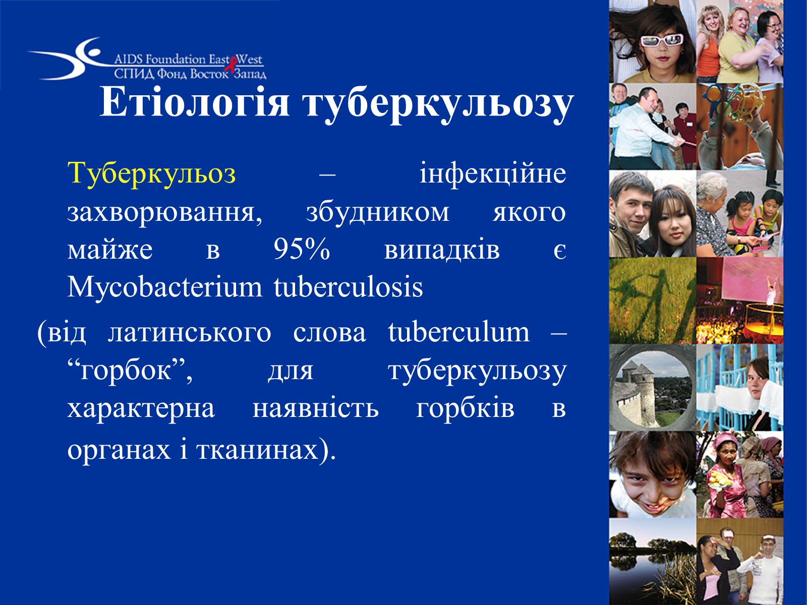 Презентація на тему «Туберкульоз» (варіант 1) - Слайд #4 Презентація на тему «Туберкульоз» (варіант 1) - Слайд #4